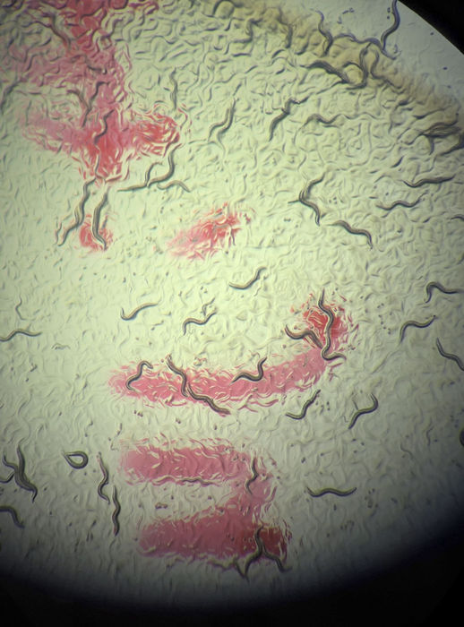 Nematodes under the microscope