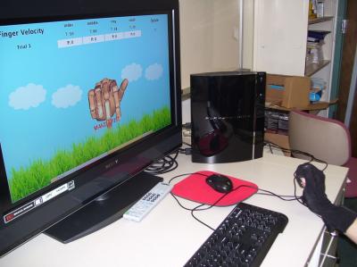 Video Game System for Hand Rehabilitation