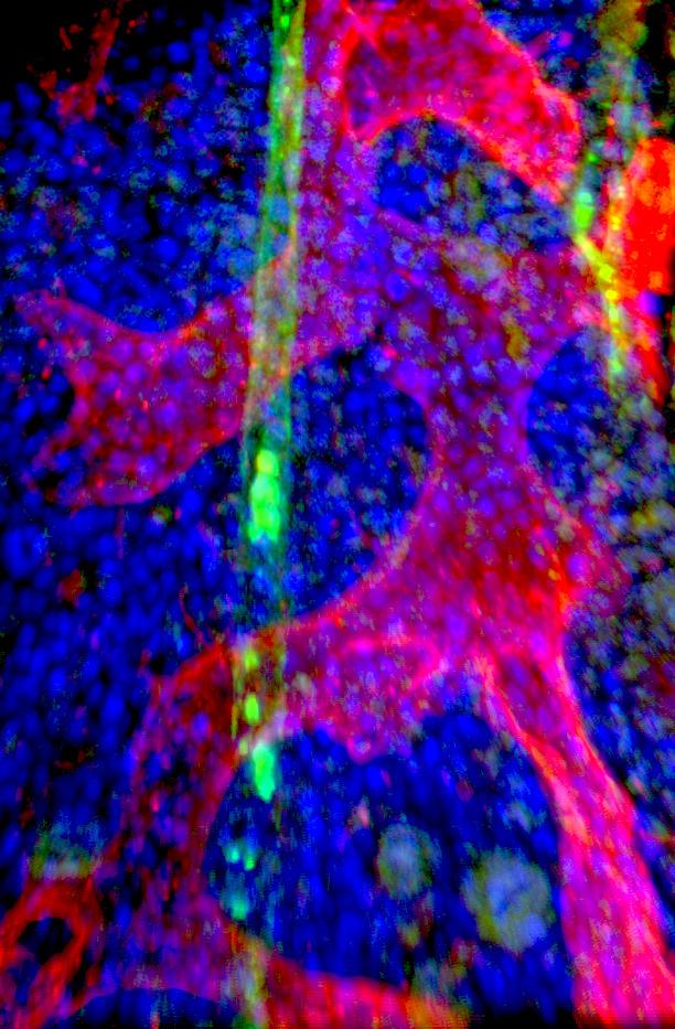 Stem cells in bone marrow