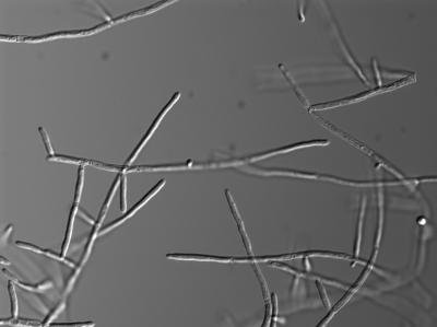<i>Candida albicans</i>