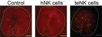 Tumor-Exposed NK Cells Help Breast Cancer Cells Form More Metastatic Tumors