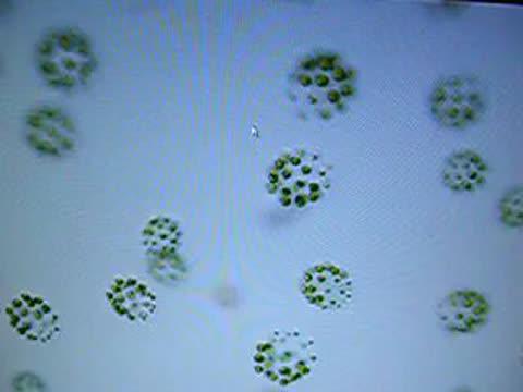 Pleodorina algae float in a water sample under a light microscope