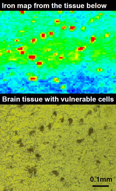Iron Map of Brain Tissue