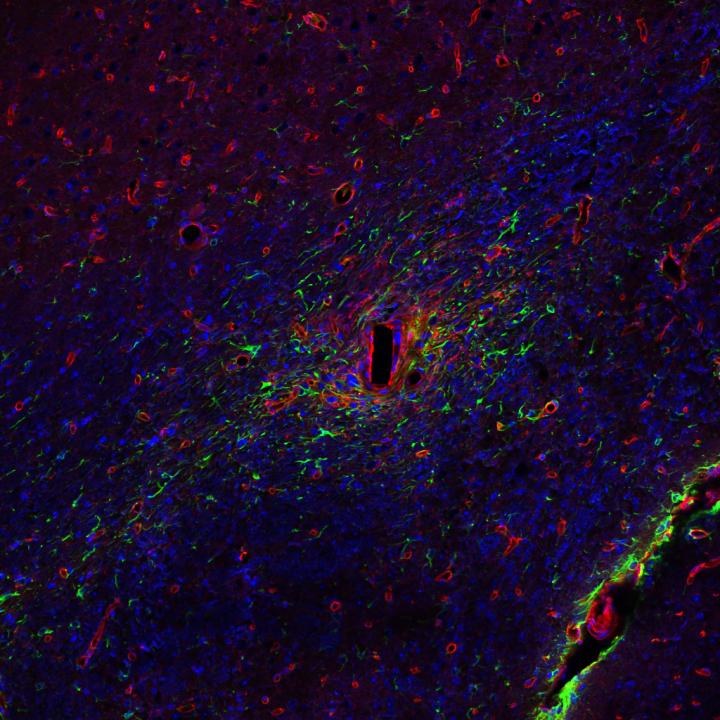 Depiction of Glial Cells
