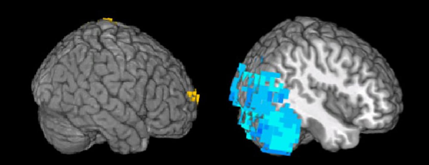 Brain of Control vs. Person with PPA