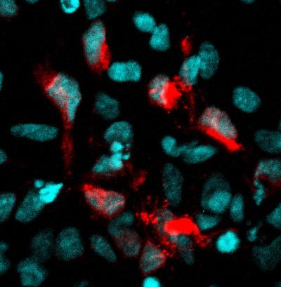 Neural Stem Cells infected with Zika
