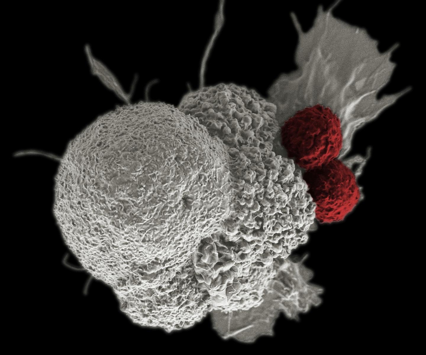 Tumor-Specific T Cells