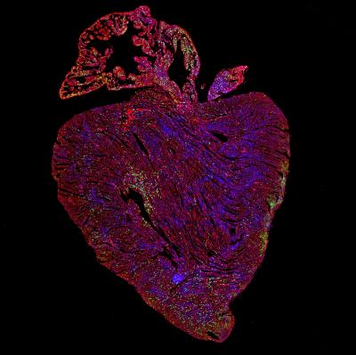 Adult Mouse Heart with Replicating Cells