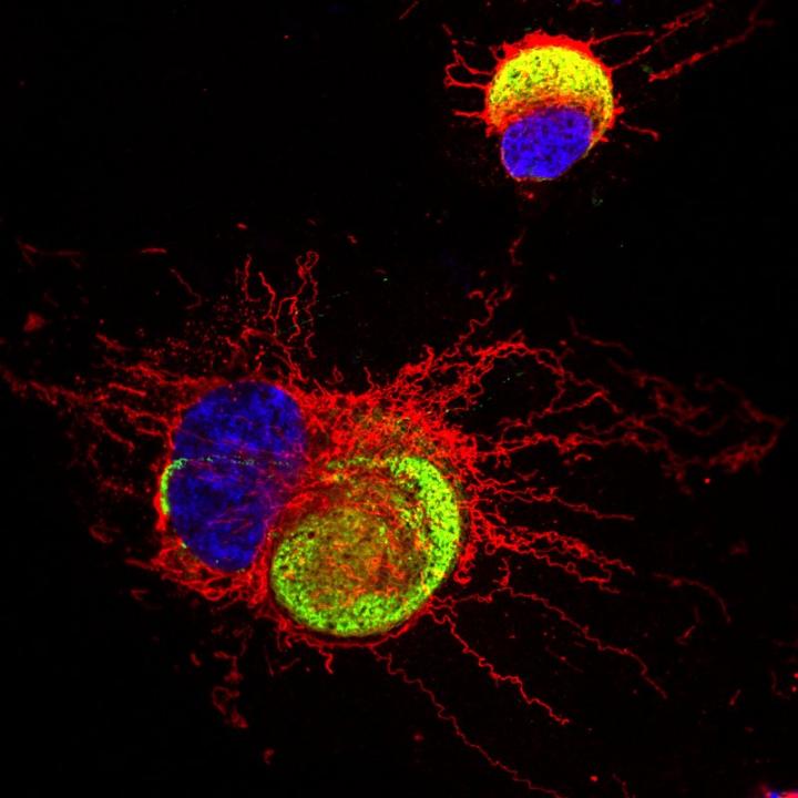 Astrocyte Infected by the Zika Virus