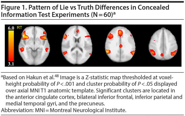 Pattern of Lie vs Truth Differences in Concealed Information Test Experiments