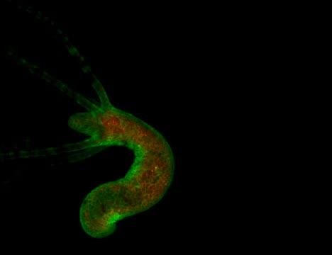 <em>Hydra vulgaris</em> Polyp Moving and Behaving