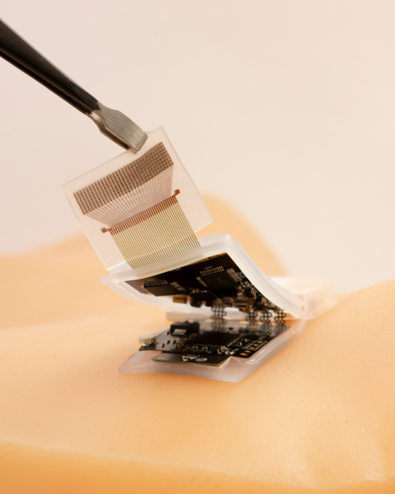 Wireless ultrasound patch 2 [IMAGE] EurekAlert! Science News Releases