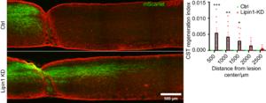 Lipin1 KD facilitates robust CST axon regeneration after complete spinal cord injury