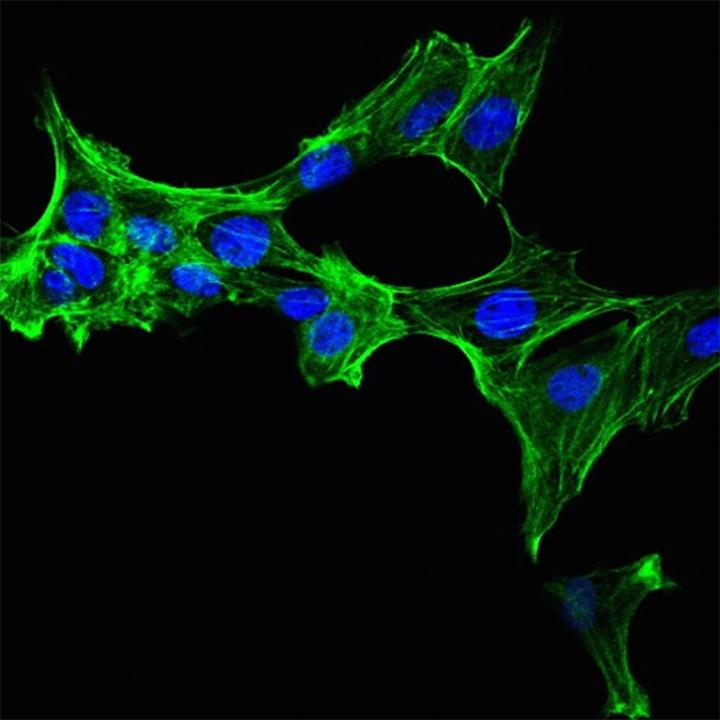 Drug Resistant Cancer Cell