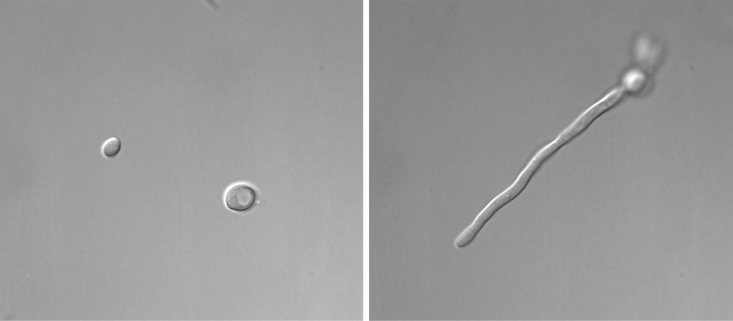 Candida albicans, in two forms