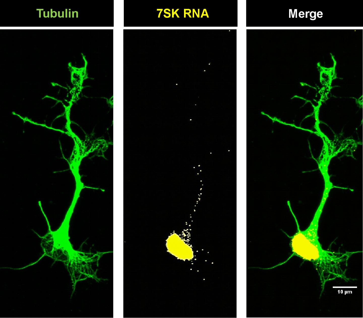 Localization of the ZSK-RNA in Motor Neurons