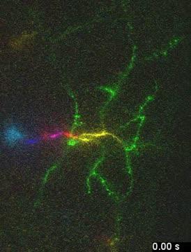 Single Neuron Calcium Imaging