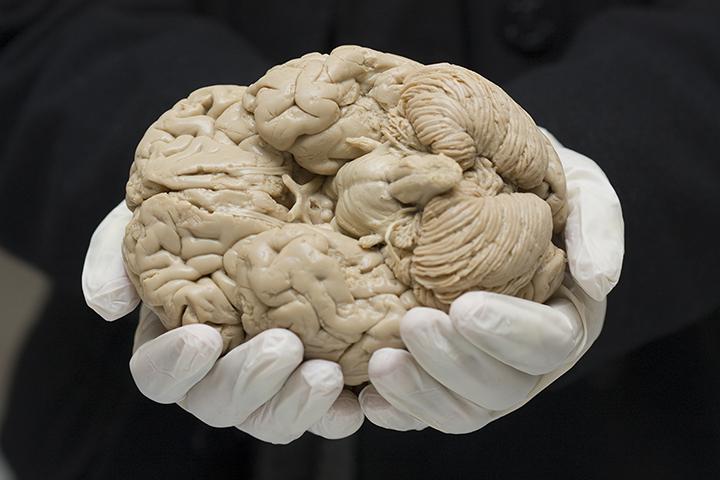 Human Brain