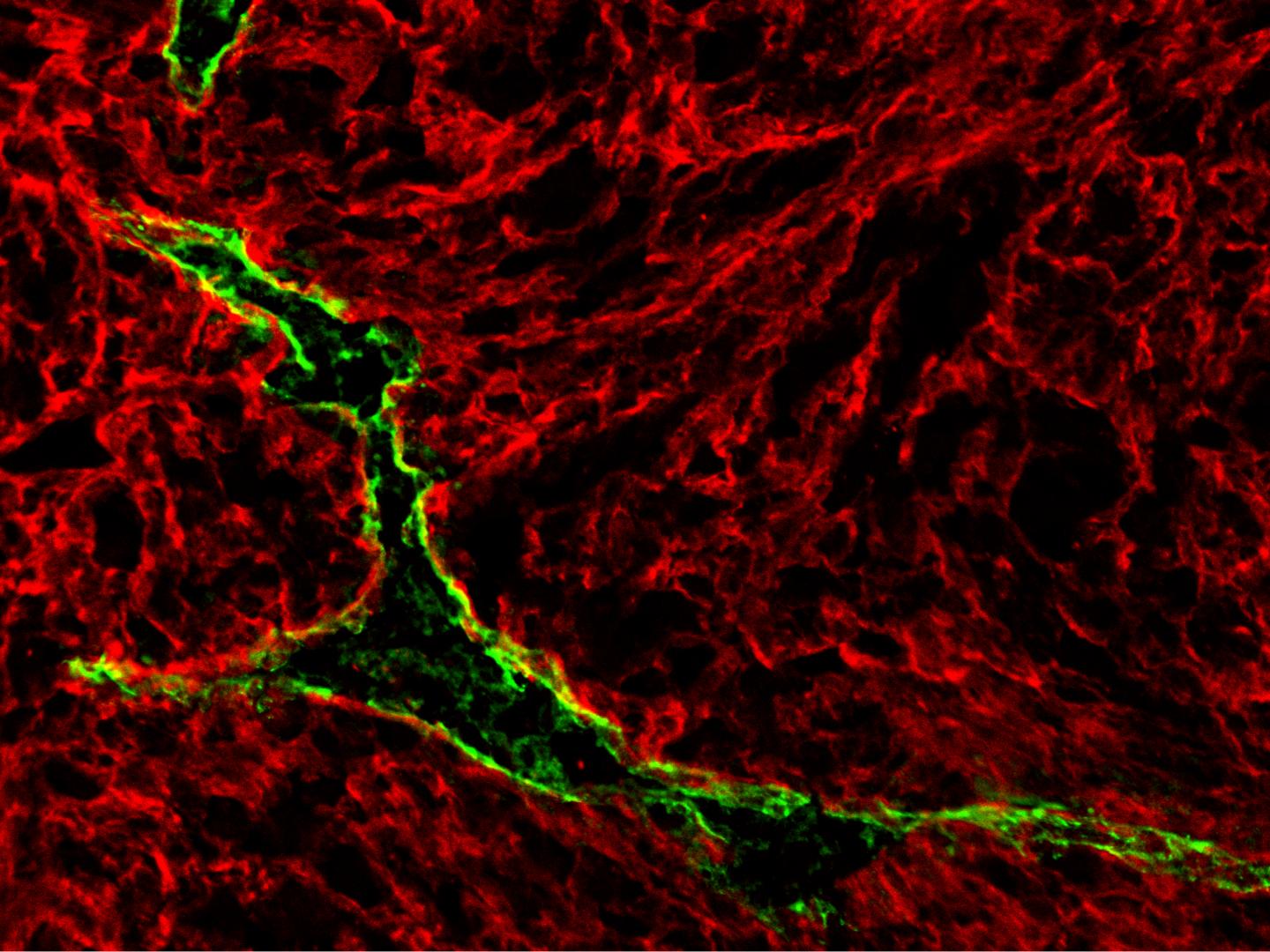 Detecting Misfolded Protein Aggregates to Diagnose Mysterious Diseases (1 of 2)