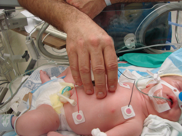 Pediatric and hot sale neonatal