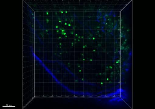 Natural Killer Cells, Shown in Green, are Attacking a Mouse Tumor
