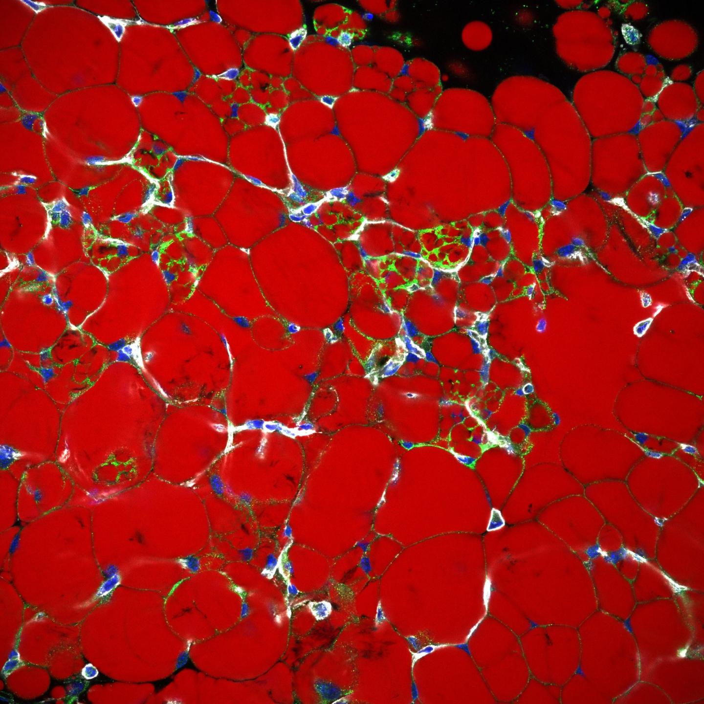 Beige adipocytes within white adipose tissue