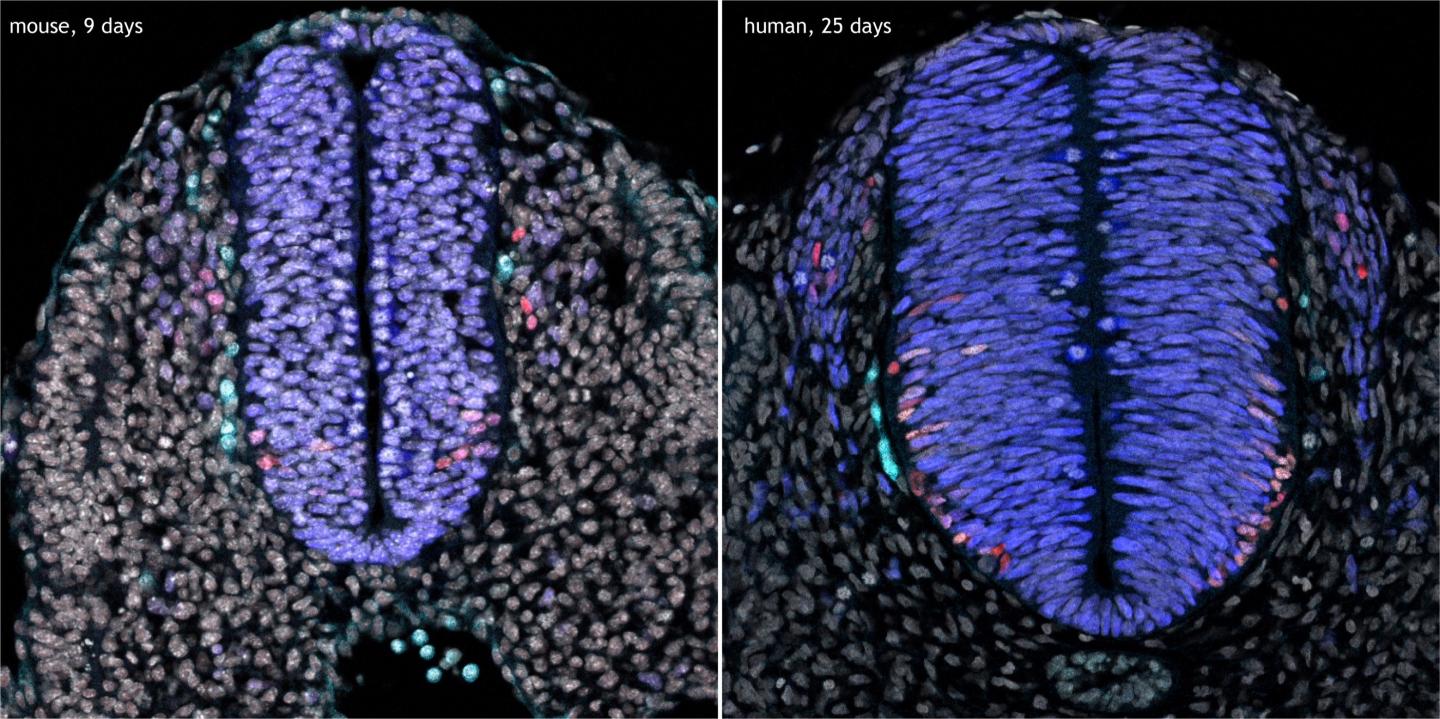 Microscope images of mouse and human spinal cord development at equivalent stages.