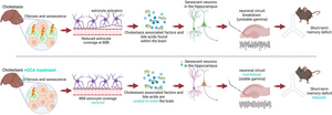 New study finds promising treatment for cognitive deficits associated with cholestatic liver disease