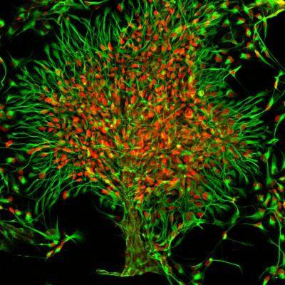 Forebrain Neural Progenitor Cells