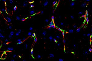 Blood vessel endothelial cells (green) and basement membrane (red) in the brain.