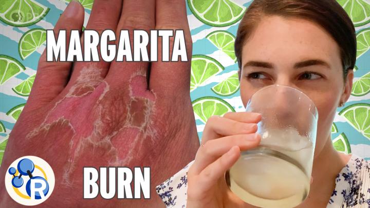Why Lime Juice Burns Your Skin in the Sun (video)