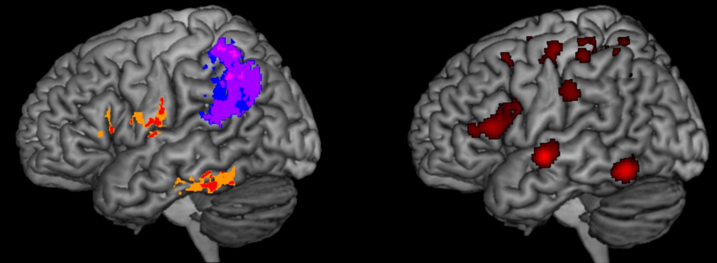 Brain and Spelling