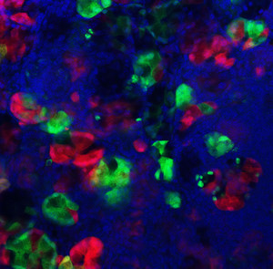 Pancreatic acinar cells