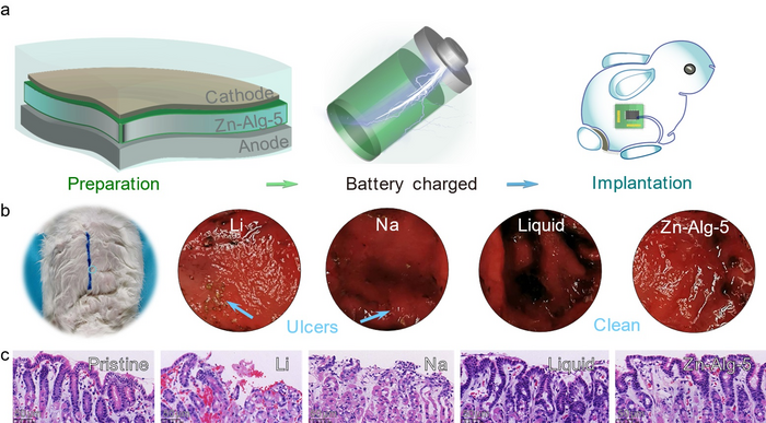 Biocompatible zinc batteries with Zn-alginate polymer electrolyte