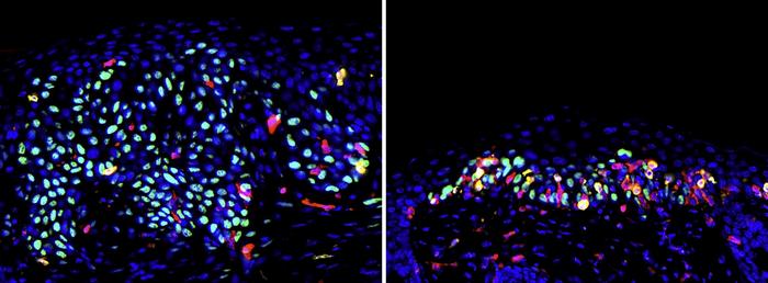 Commensal papillomavirus immunity preserves the homeostasis of highly mutated normal skin