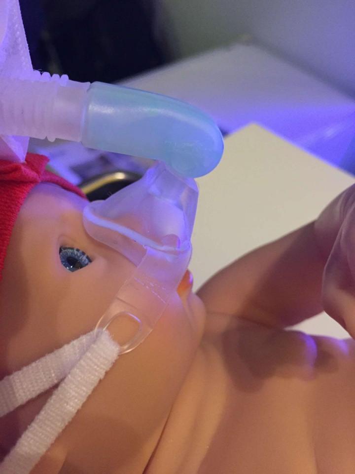 New Noninvasive Ventilation Strategy Allows Preterm Infants to Breathe Freely