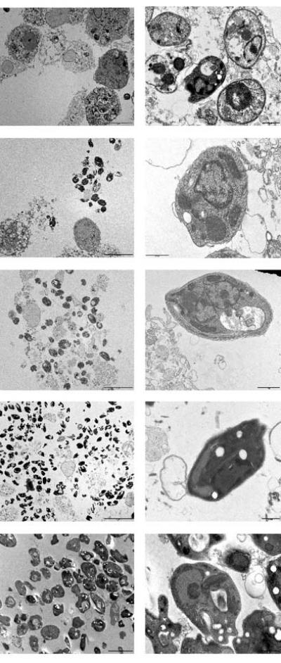 Leishmania Purification