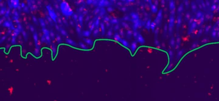 A physics perspective on wound healing