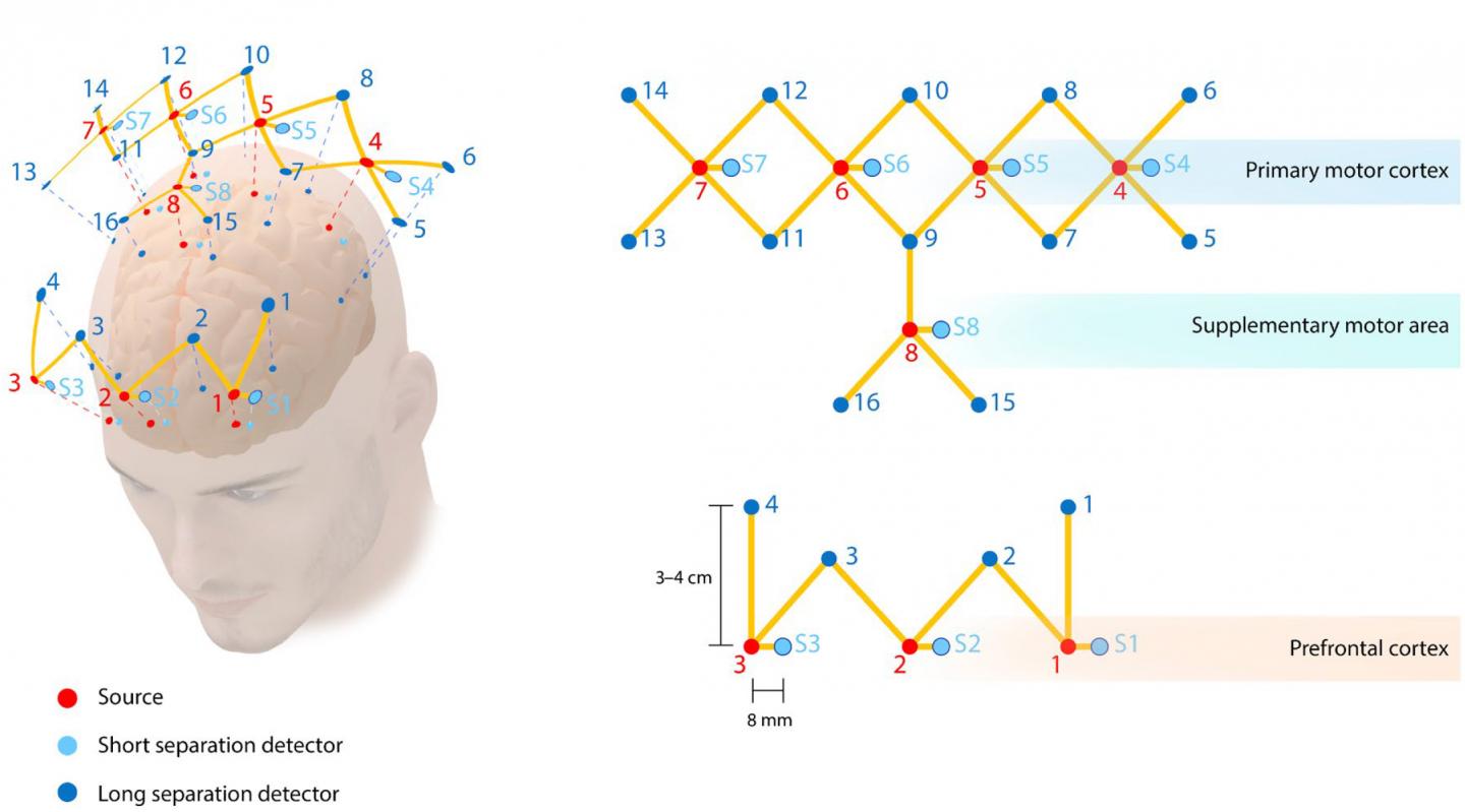 Cutting-Edge Brain Imaging Method Accurately Evaluates Surgeon Skill Levels (2 of 3)