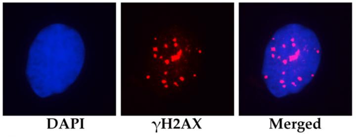 Fig. 1 Mesenchymal Stem Cell Nucleus on a Microphotograp