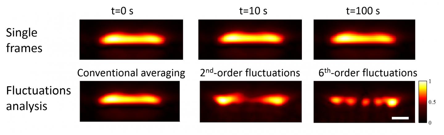 High-resolution Photoacoustic Imaging