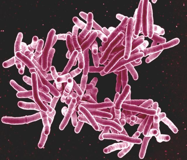 <i>Mycobacterium tuberculosis</i> Bacteria
