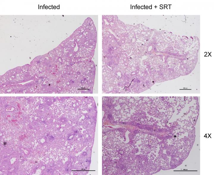 Potential Tuberculosis Therapy Targets the Patient, Not the Bacteria, to Prevent Drug Resistance (3 of 3)