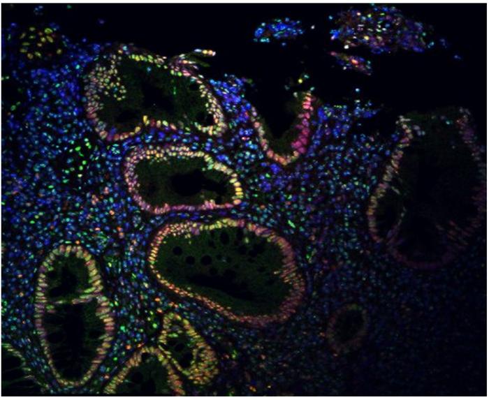 Nerve stimulation modulates SUMOylation to ease IBD