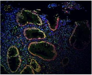 Nerve stimulation modulates SUMOylation to ease IBD