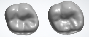 Tooth comparison