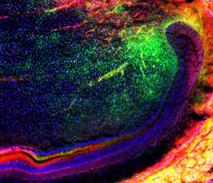 Mesenchymal Stem Cells