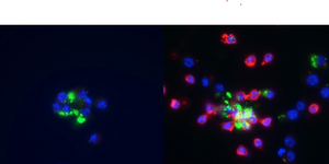 Intracellular bacteria use sophisticated ‘hack’ to evade a host’s immune system