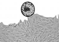 Histological Slide, Demonstrating uNK Cells in the Womb Lining