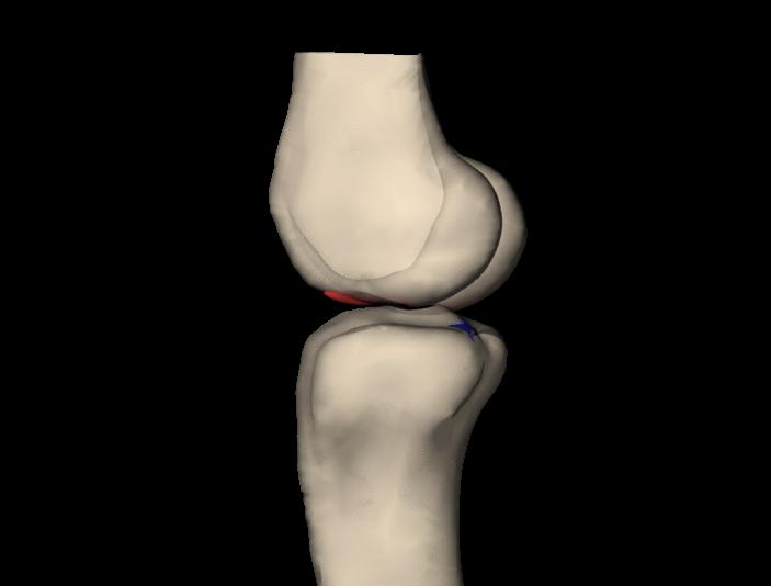 A Look Inside the Knee